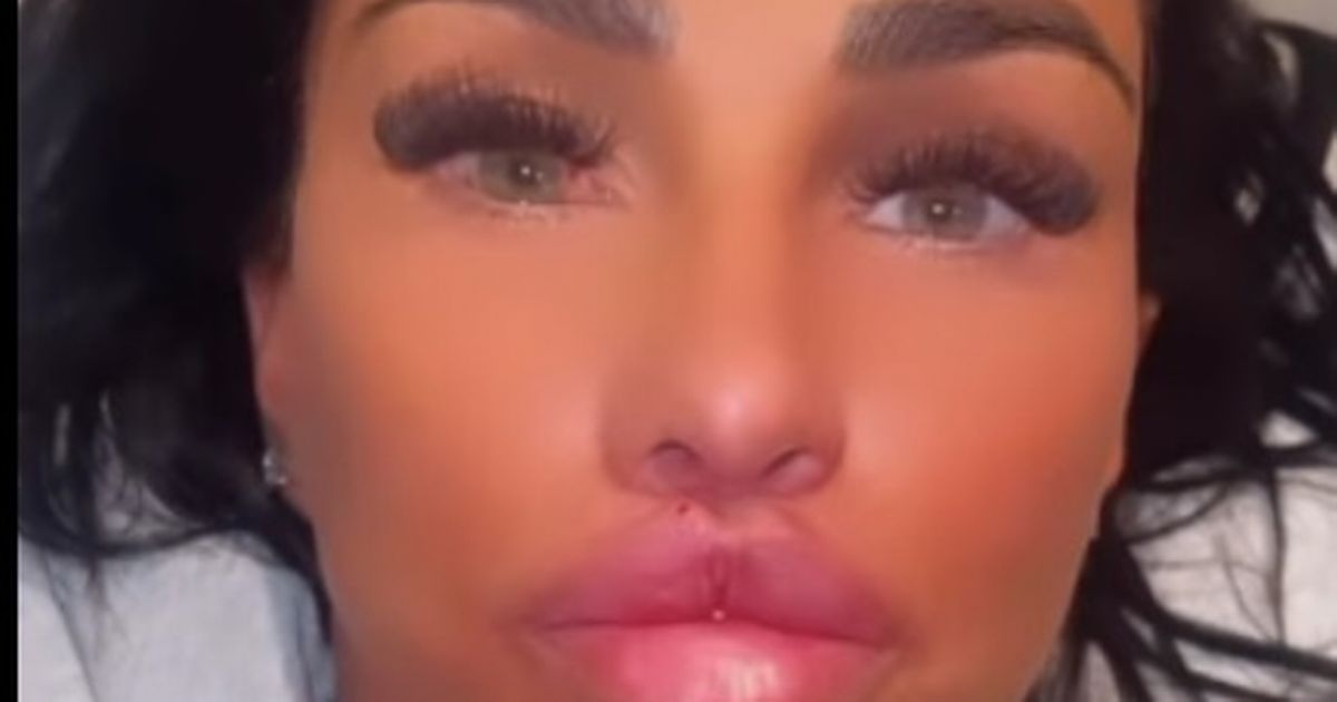 Katie Price reveals new lips and bum as she shares gruesome video of filler being injected