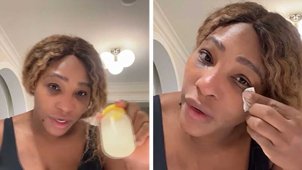 Serena Williams Says Her Breast Milk Helped Heal Her Facial Sunburns